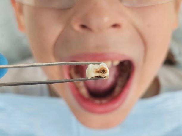 Best Emergency Care for Gum Disease in Friendswood, TX